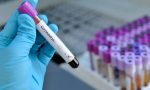 Coronavirus, 3500 nuovi casi in Toscana il 23 luglio: ricoveri in calo (-32) e soprattutto zero decessi
