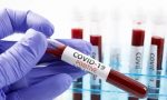 Coronavirus, 4.083 nuovi casi in Toscana il 15 aprile: 18 decessi ma anche 40 ricoveri in meno